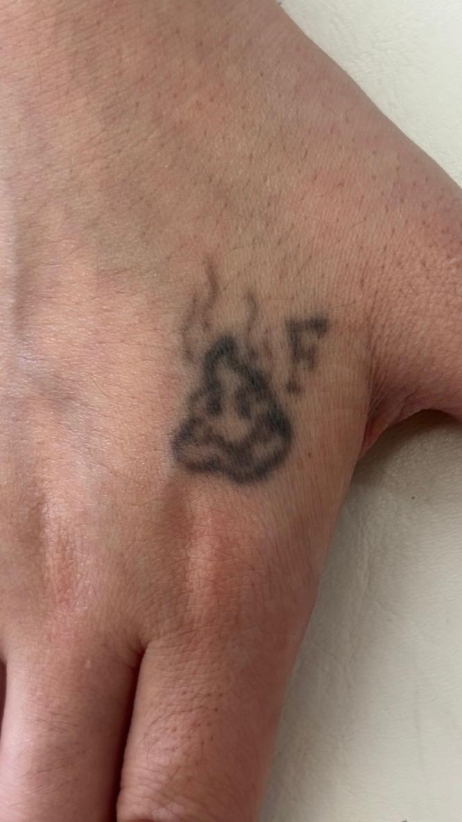 Tatuagem na mão — antes da sessão