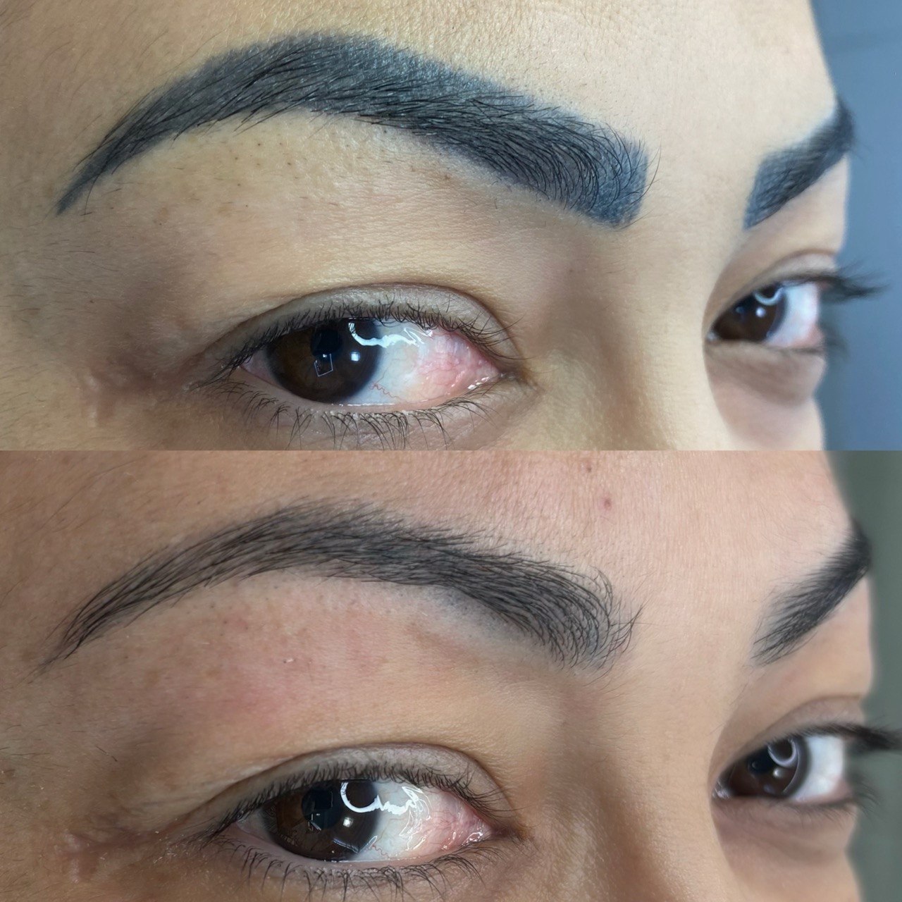 Antes e depois — sobrancelha renovada