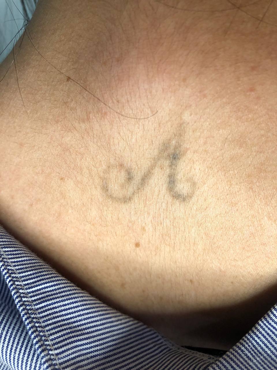 Tatuagem no pescoço — antes