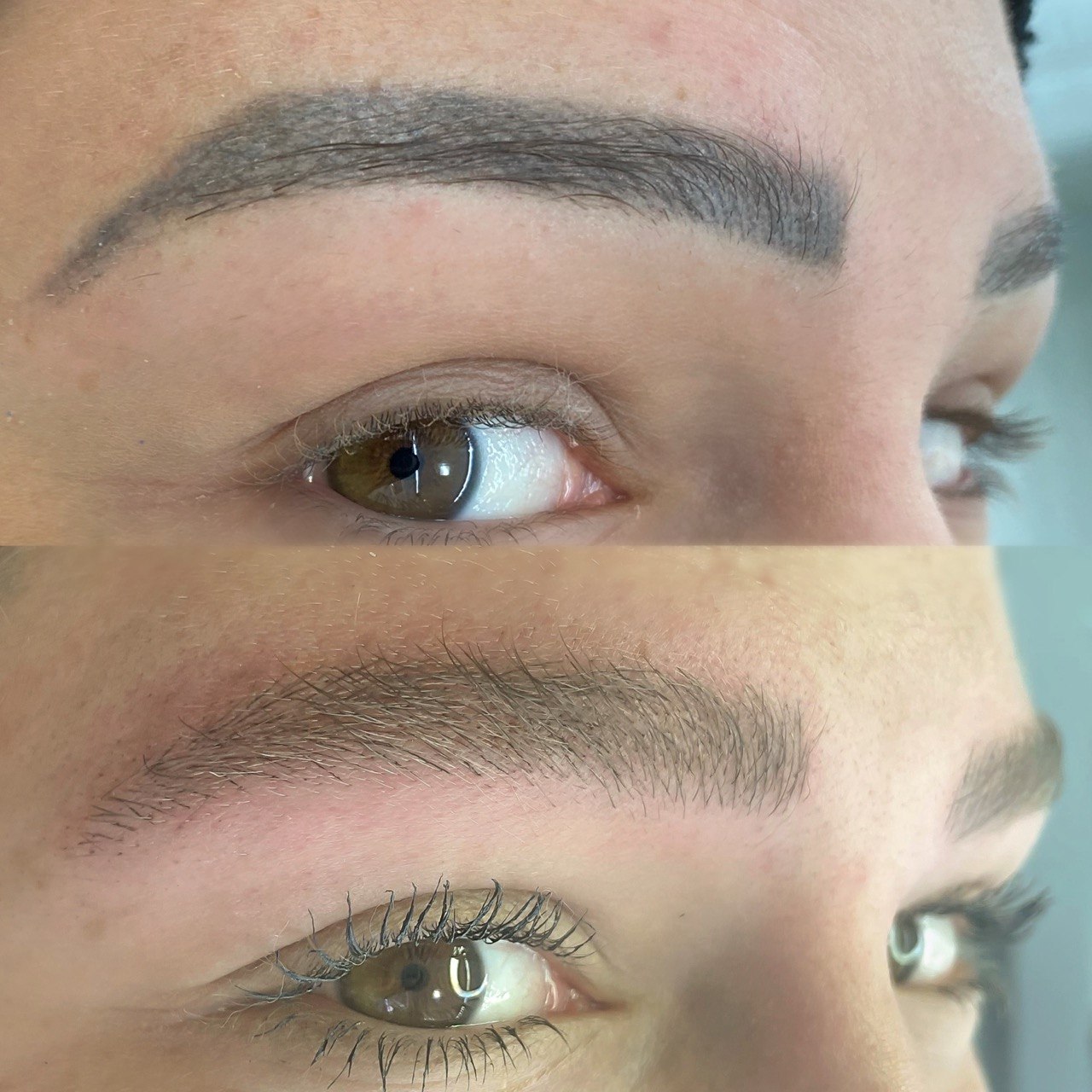 Antes e depois — despigmentação de sobrancelha  