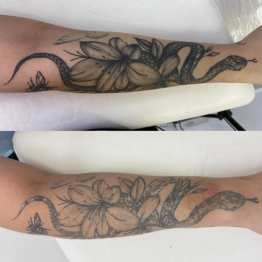 Antes e depois — clareamento progressivo